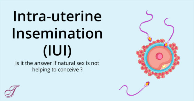 IUI treatment in Vashi, Navi mumbai