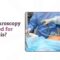 Laparoscopy